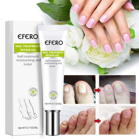 Efero 20g Nail Repair Gel